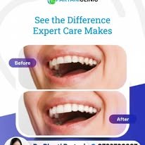 Expert dental care result