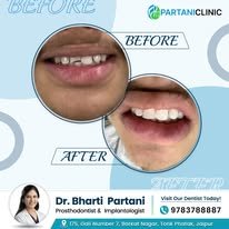 Cosmetic dentistry result