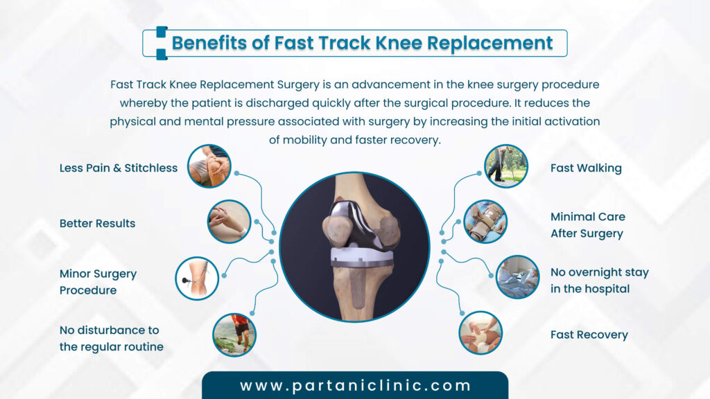 What are the benefits of FastTrack Knee Replacement? Partani Clinic