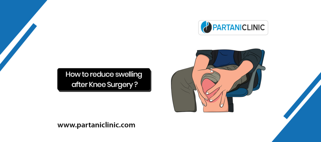 How to reduce swelling after Knee Replacement in 2022 | Dr. Arun Partani