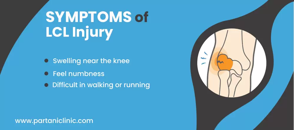 symptoms of LCL
