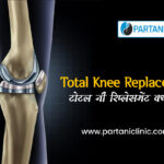 Total Knee Replacement in Hindi