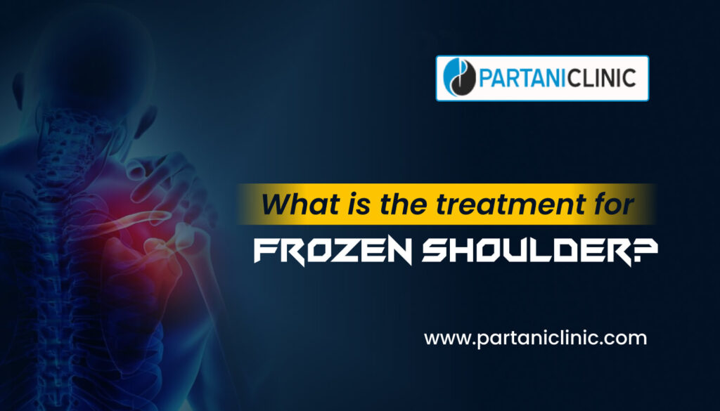 What is the treatment for Frozen Shoulder? Partani Clinic