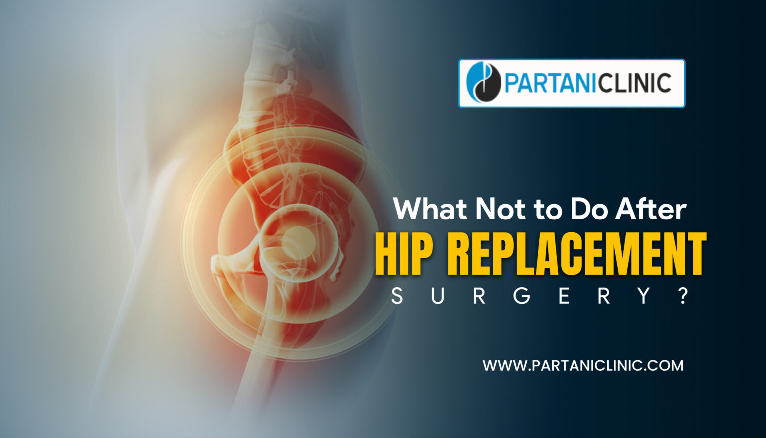 What NOT to Do After Hip Replacement Surgery? Partani Clinic