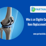 Eligible Candidate for Knee Replacement Surgery