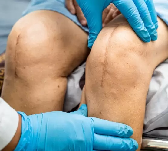 knee-replacement-cost