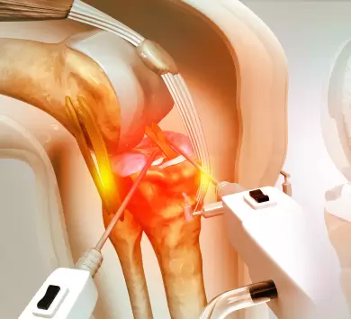 knee-replacement-surgery