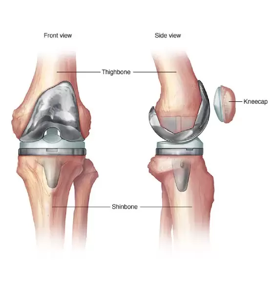 precautions-and-recovery