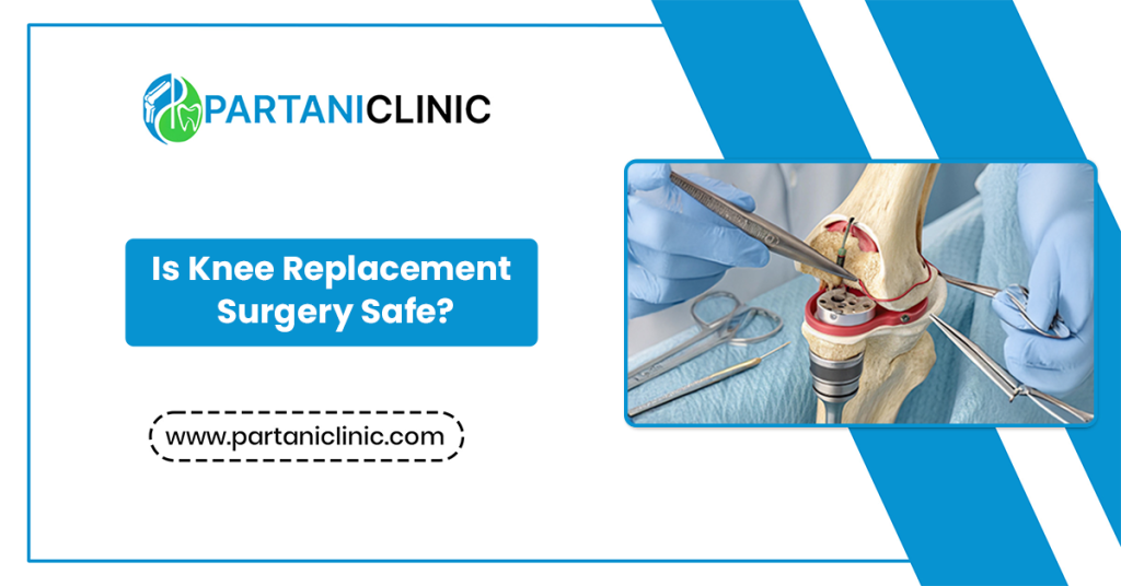 is knee replacement surgery safe
