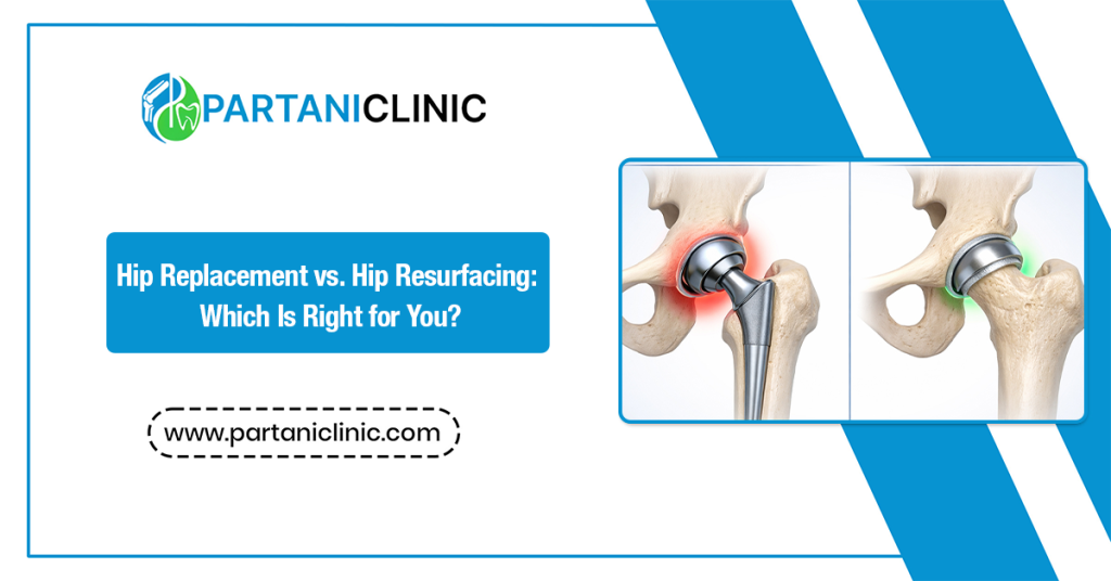 Which is better hip replacement or resurfacing