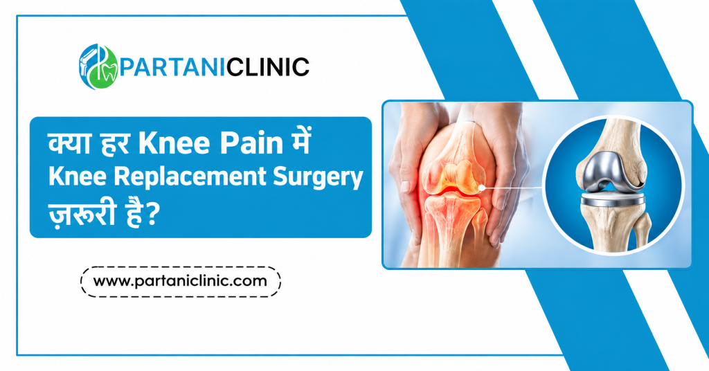 Knee Replacement Surgery