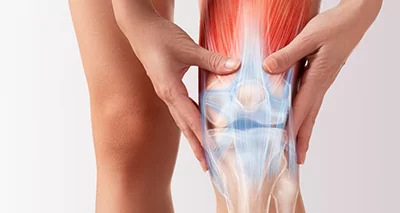 Knee Replacement
