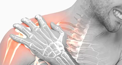 Rotator Cuff