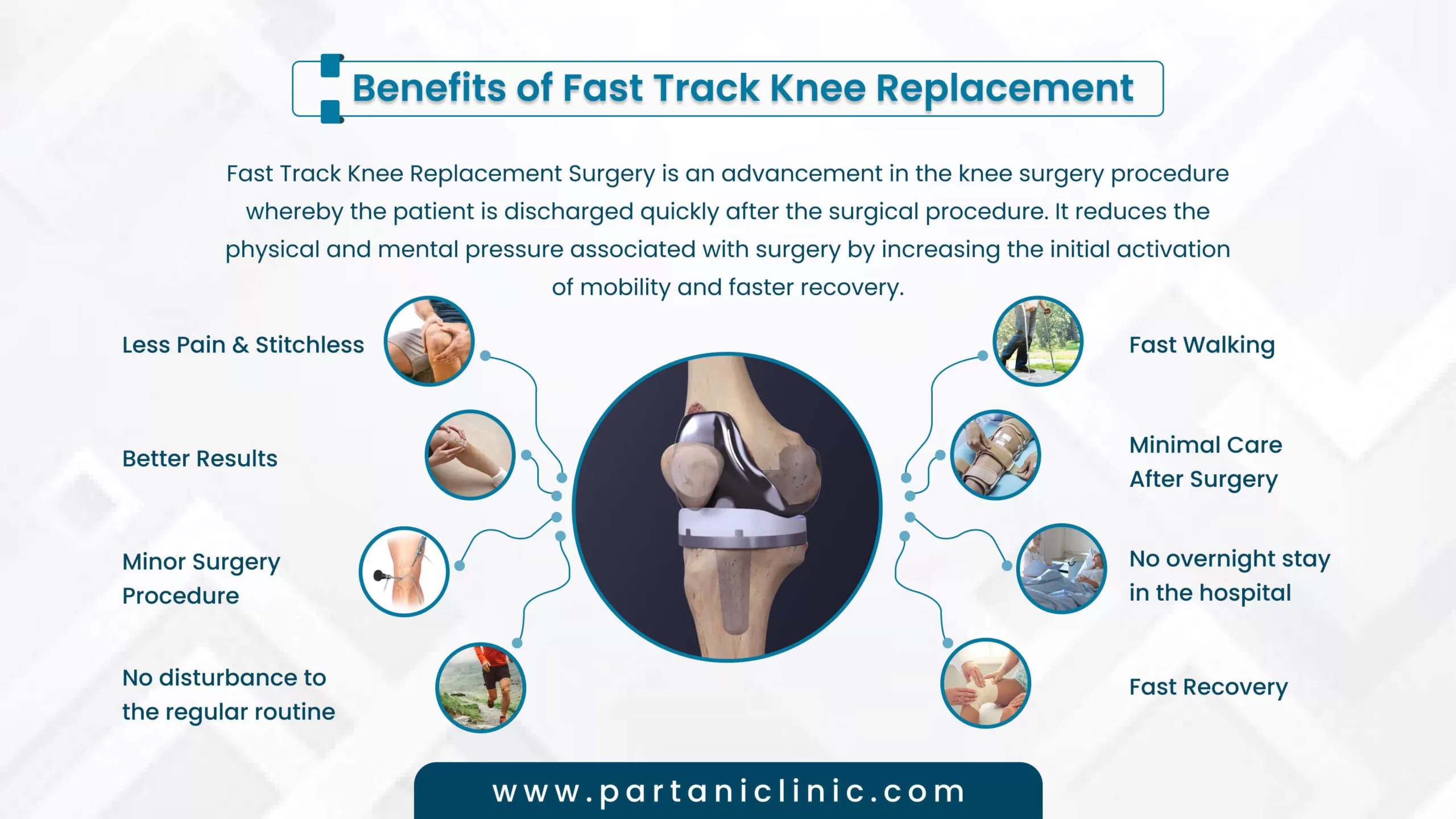 benefits of dast track knee replacement