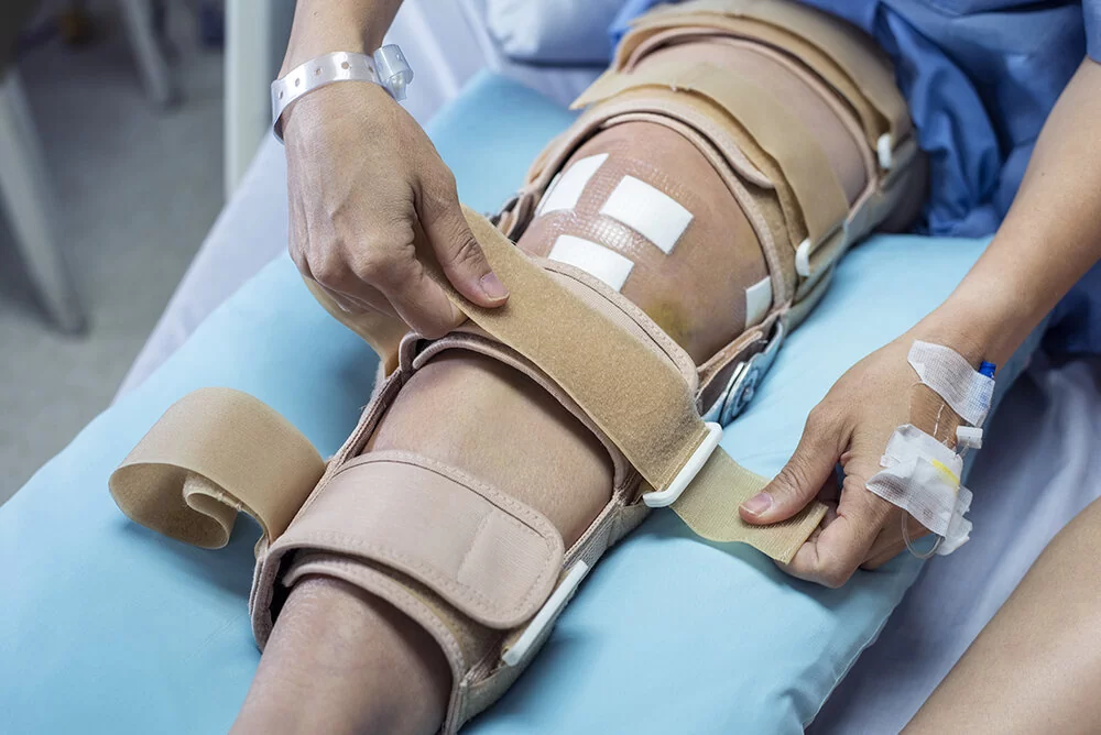 minimal care after surgery