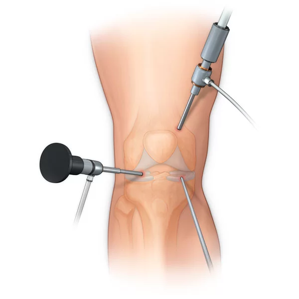 minor surgery procedure