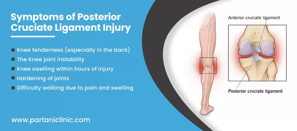 PCL Tear surgery in Jaipur