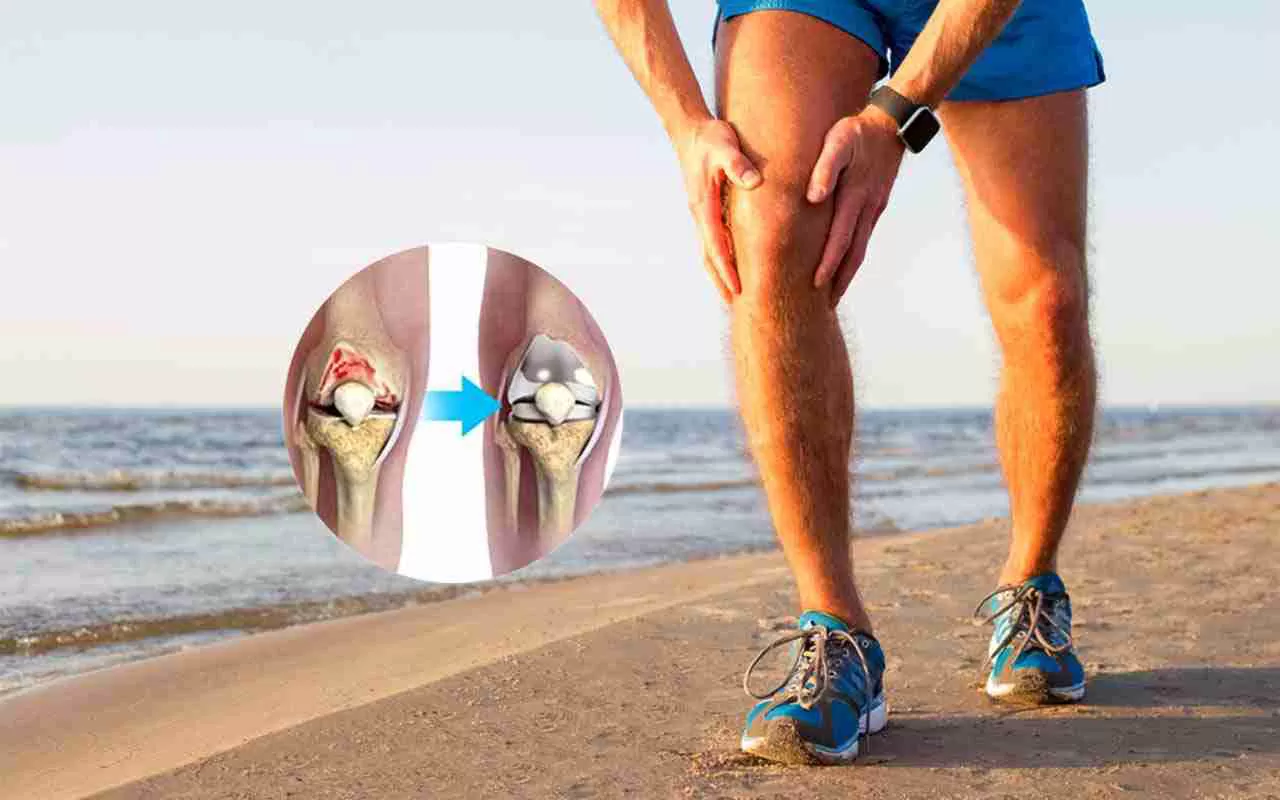 What Should I Do After Total Knee Replacement?