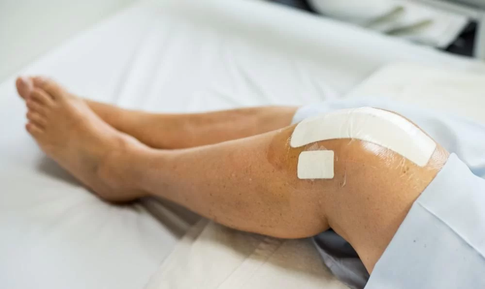minimum knee pain