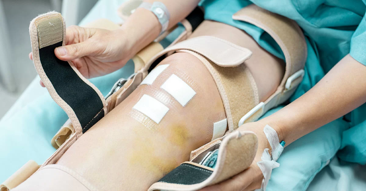 minimum knee pain