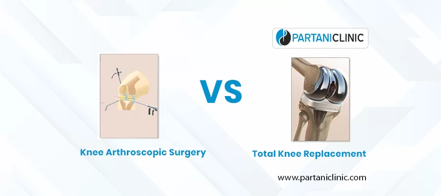 Knee Arthroscopic vs Knee Replacement