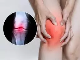 rheumatoid-arthritis