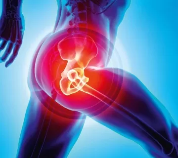 eligible-hip-replacement